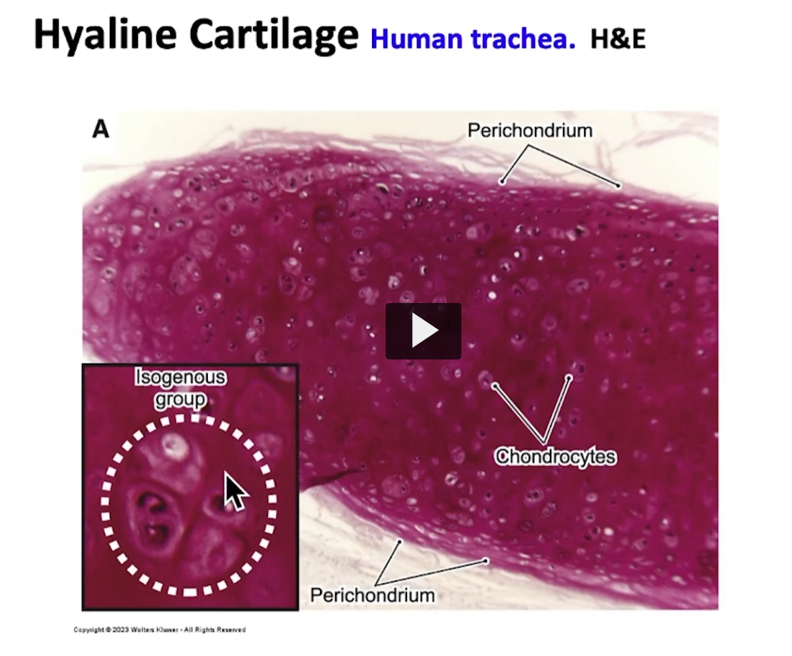 <p>Here I am magnifying the isogenous group. The rings of the trachea is normally a classic model to observe hyaline cartilage. How do you visualize an isogenous group? What do chondrocytes look like in electron microscopy? </p>