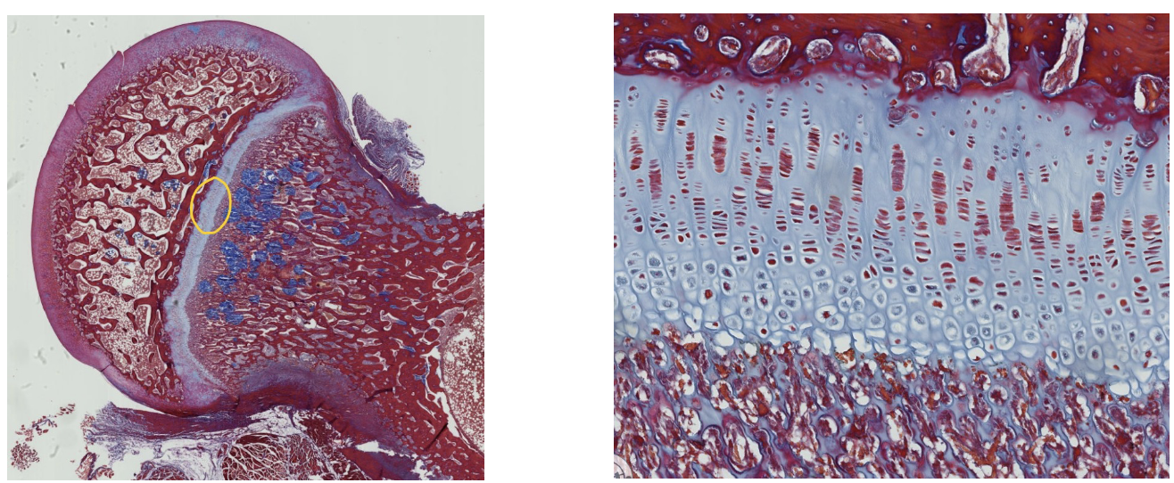 <p>ID the specific type of CT that makes up the physis of the long bone shown in this region.</p>