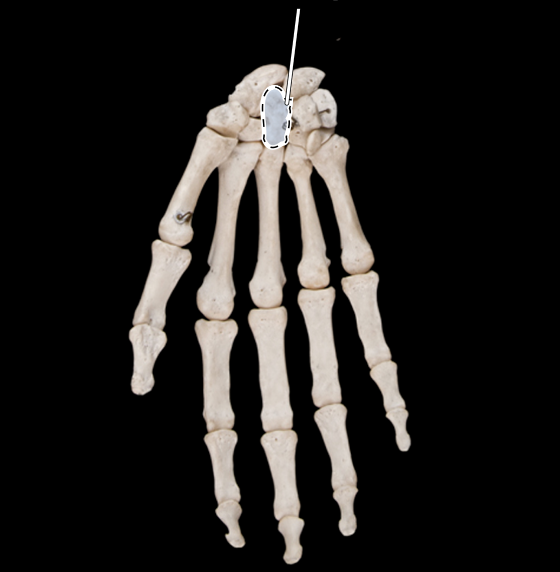 <p>anterior view</p>