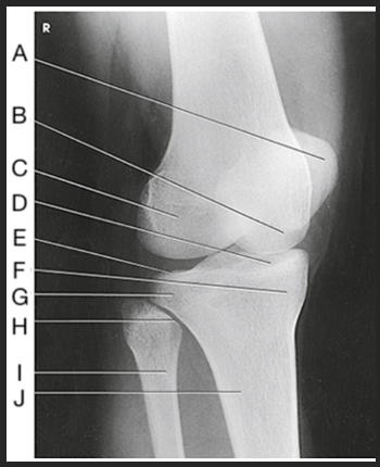 <p>Label the image: J</p>