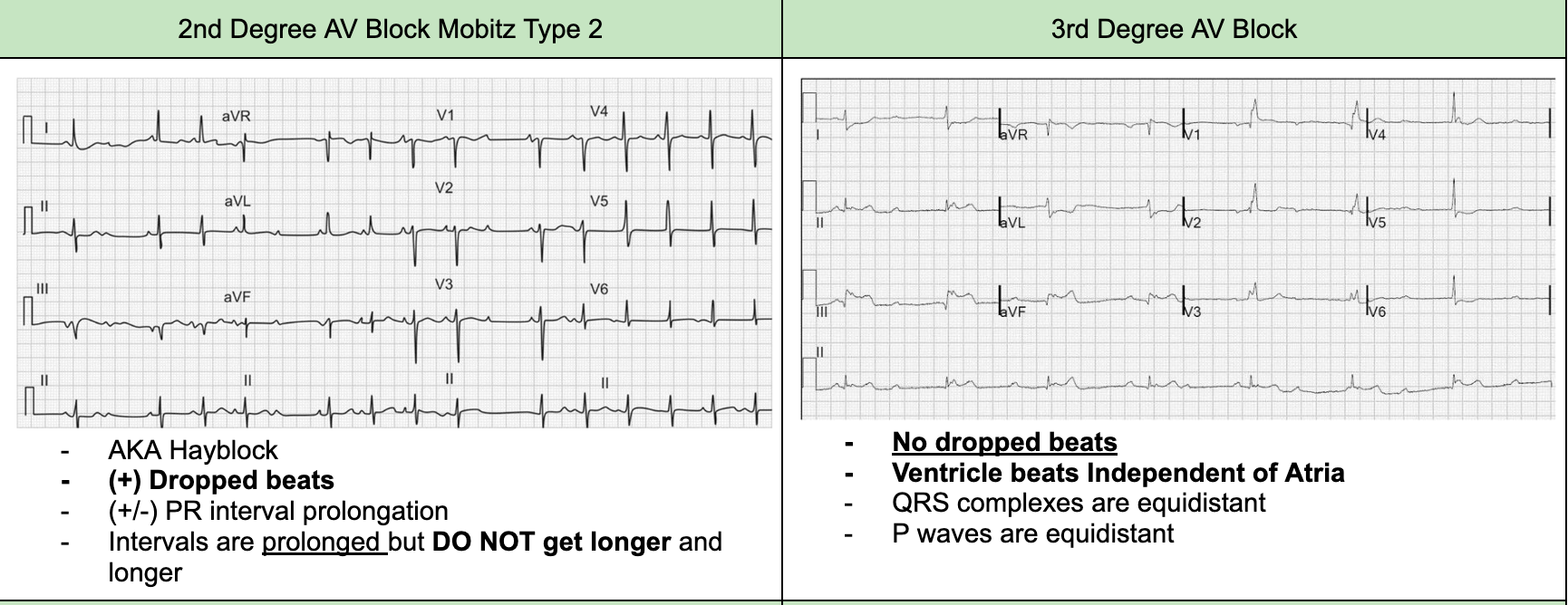<p>cardio consult to correct<span style="background-color: transparent;"> pathologic causation or </span>place ICD</p>
