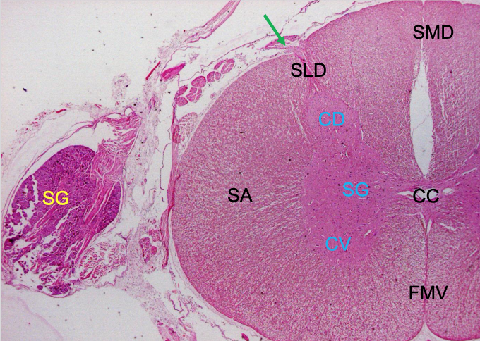 term image
