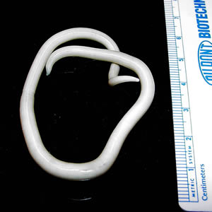 <p>Ascaris lumbricoides Female Anatomy </p>