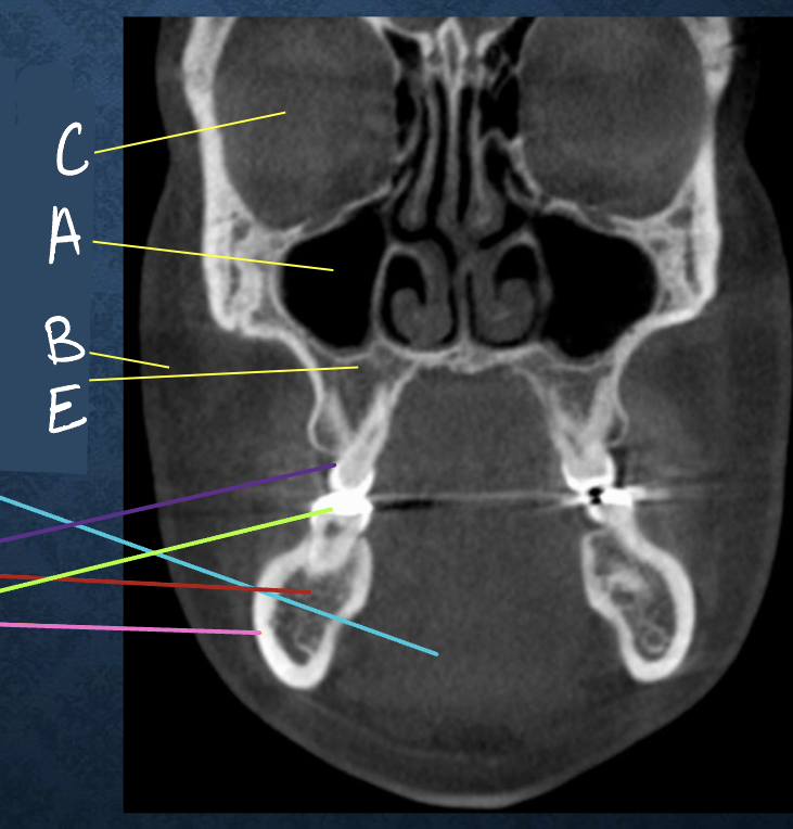 <p>a?</p>