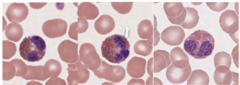 <p>Bi-lobed dark purple nucleus with red-orange granules in cytoplasm. </p><p>Red staining, grainy cytoplasm (visible granules). Bilobed nucleus. </p><p>Granulocytes.</p>