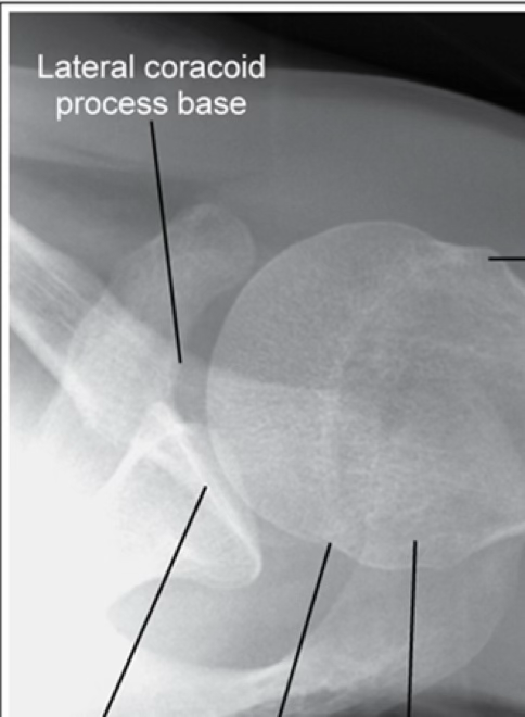 <p>Inferosuperior Axial (lawrence)</p>