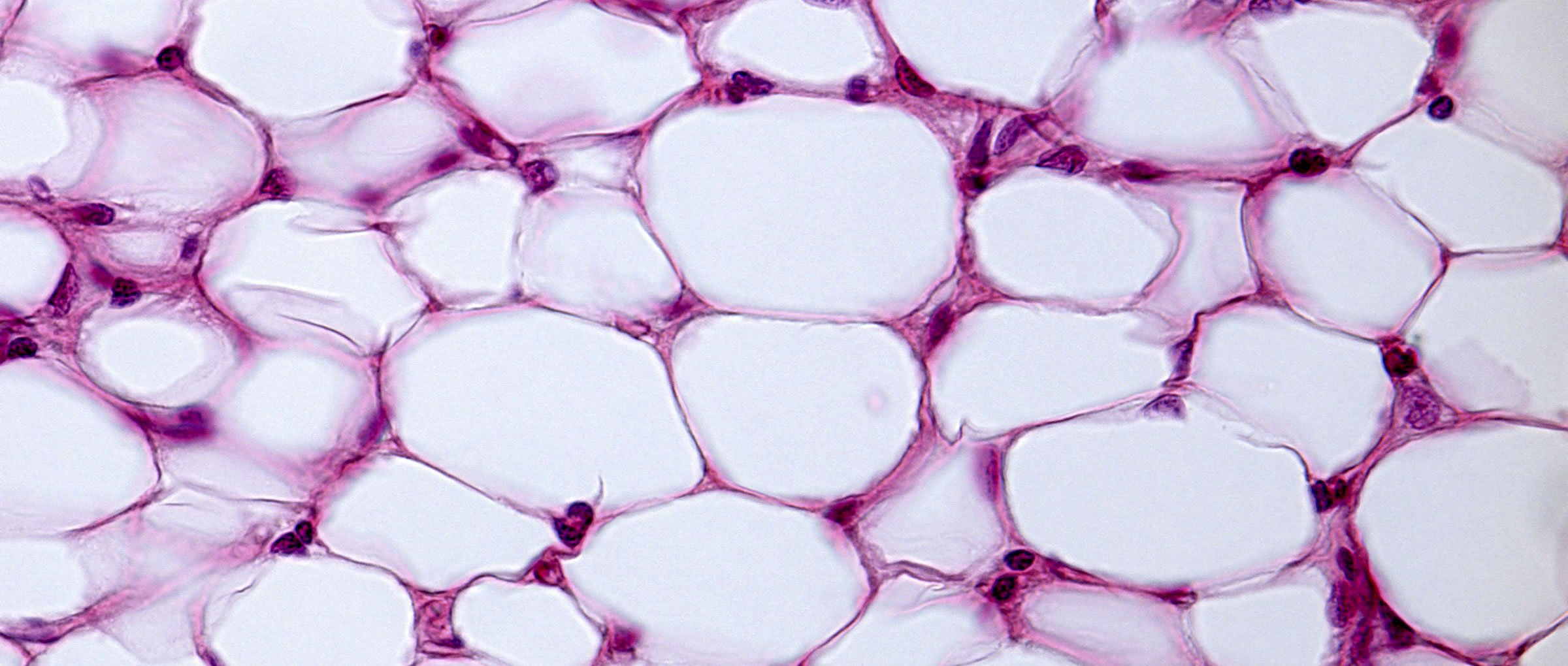 <p>Connective tissue proper, lipid store is removed in fixation process leaving empty bubble; nucleus often flattened, thin cytoplasm ring around bubble</p>