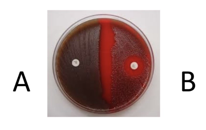 <p>Optochin Sensitivity Test</p><p>a) Medium?</p><p>b) Substrate?</p><p>c) Enzyme?</p><p>d) Indicator/Reagent?</p><p>e) End Product?</p>