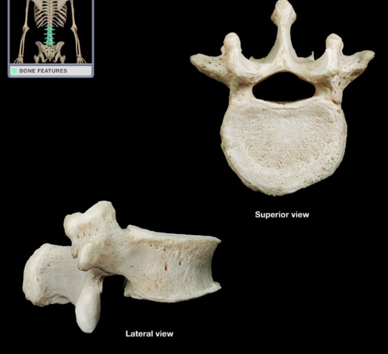 <p>What kind of vertebrae?</p>