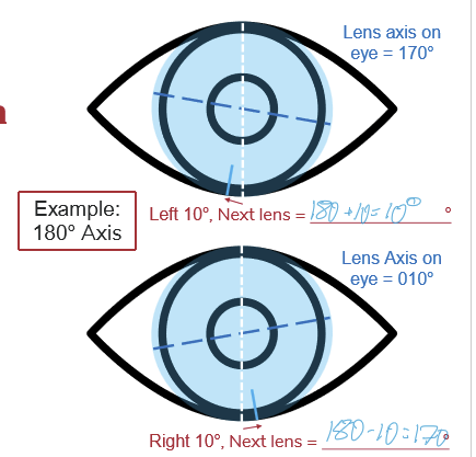 <p>LARS tells the clinician which axis to select next when a toric lens rotates:</p><ul><li><p>Left rotation → Add degrees to the axis</p></li><li><p>Right rotation → Subtract degrees from the axis</p></li></ul><p></p>