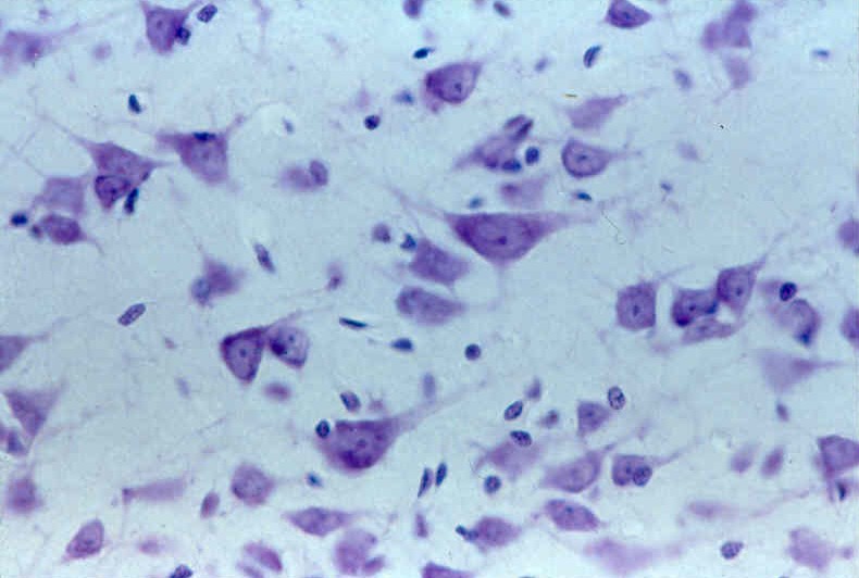 <p>label each - neurons / glial cells</p>