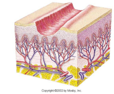 <ul><li><p>irritated, erosed, or ulcerated by manual damage like scratching</p></li><li><p>loss of epiderm.; linear hollowed out crusted area</p></li></ul><p></p>