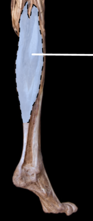 <p>Origin:</p><ul><li><p>Lateral Head: Lateral condyle of the femur</p></li><li><p>Medial Head: Medial condyle of the femur</p></li></ul><p>Insertion: Posterior calcaneal tubercle</p><p>Action:</p><ul><li><p>Plantar Flexion of ankle when knee is extended (Primary)</p></li><li><p>Knee flexion when ankle is dorsiflexed (secondary)</p></li></ul><p>Innervation: Tibial Nerve</p>