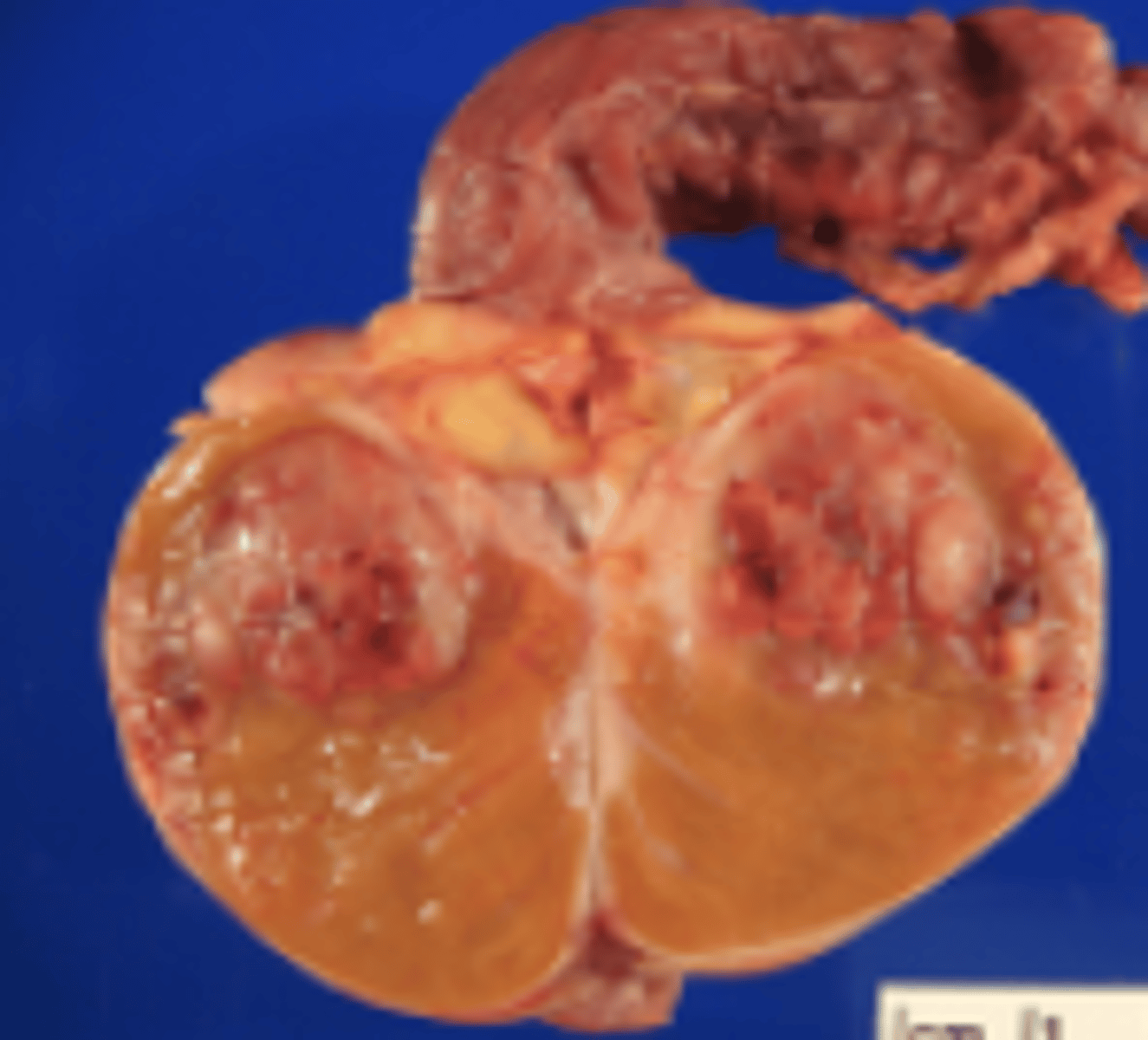 <p>to split a specimen exposing the inner contents like a clam (testicles, kidney, uteri)</p>