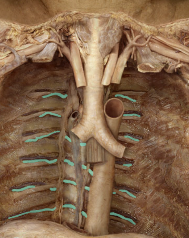 <p>Identify the feature of the thoracic aorta</p>