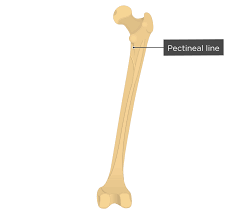 <p>narrow ridges of bone, less prominent then a crest</p>