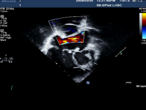 <p>Describe the findings of this image.</p>