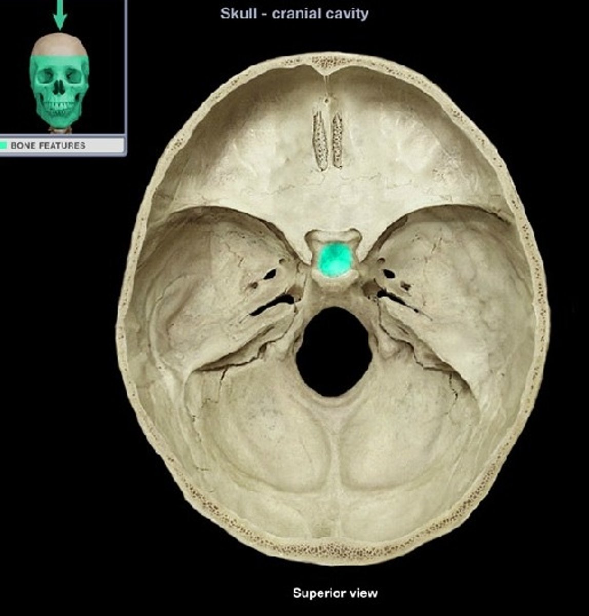 <p>Fossa for pituitary gland</p>