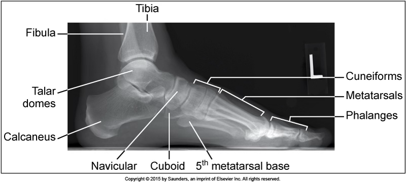 <p>medialateral foot</p>