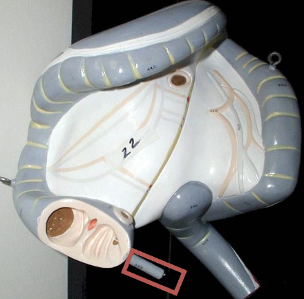 term image
