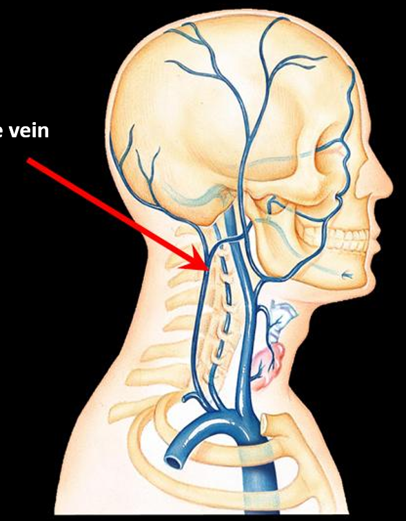 <p>Identify the vein?</p>
