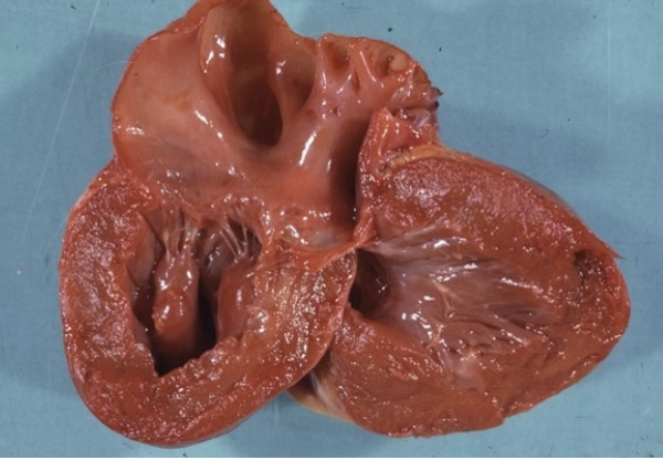 <p><strong>En katt kommer in till kliniken pga plötsligt uppkommen förlamning i bakbenen. Katten avlivas och du obducerar den.</strong></p><p class="p1"><strong>Vid obduktionen ses förändringar i vänster sida av hjärtat förenligt med hypertrofisk kardiomyopati (se</strong></p><p class="p1"><strong>nedanstående bild).</strong></p><p class="p2"><strong>b)</strong> Vilken är den mest troliga anledningen till att katten är bakdelsförlamad och hur har denna förändring uppkommit? <strong>(2p</strong></p>