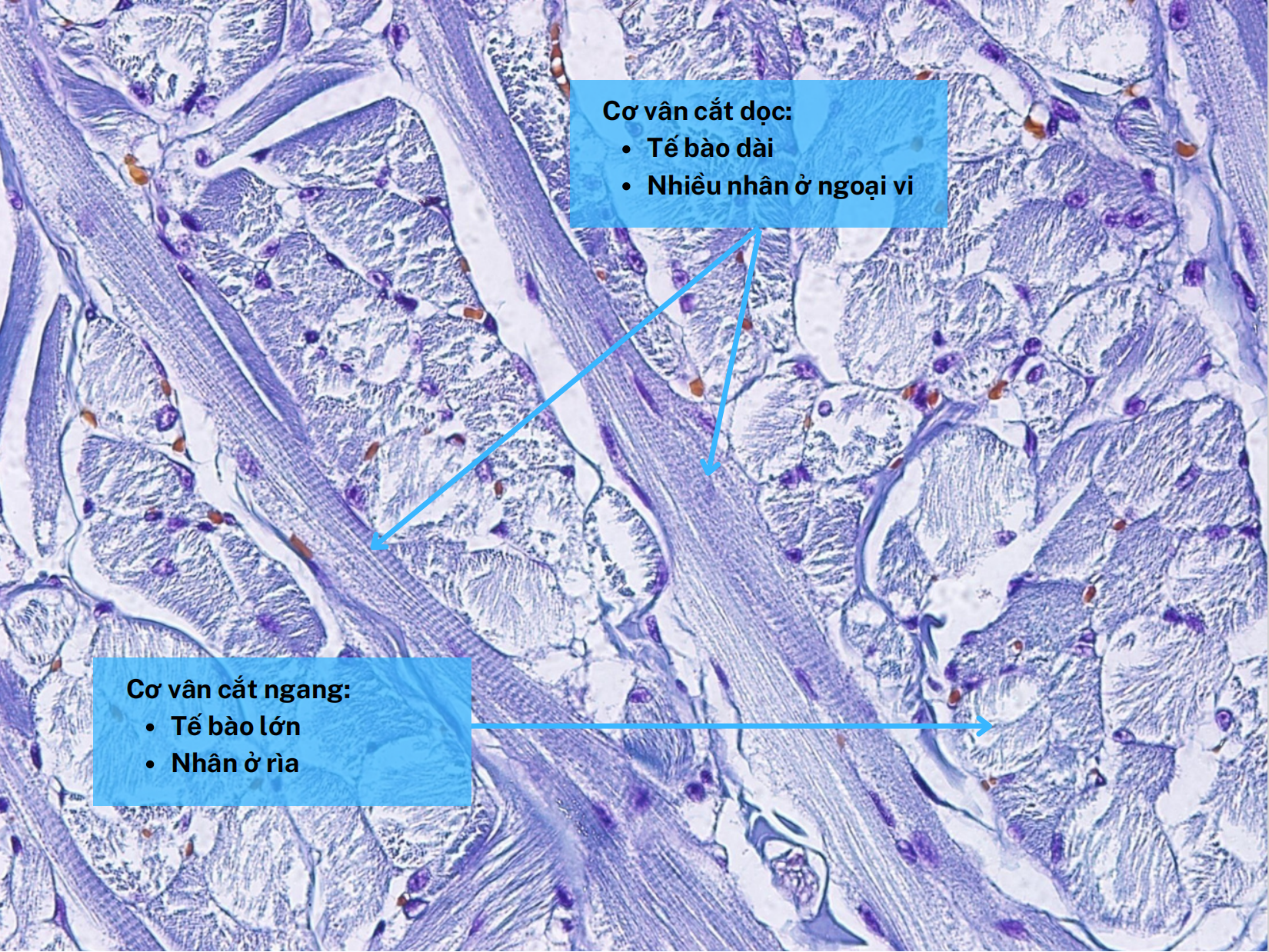 <p>Cơ vân cắt ngang</p>