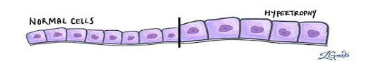 <p>An increase in the size of a cell, resulting in an increased organ size.</p><p></p>