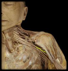 <p>Identify the structure</p>