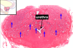 <p>what is the histological classification of the glands being pointed to by the blue arrows and what do they secrete</p>