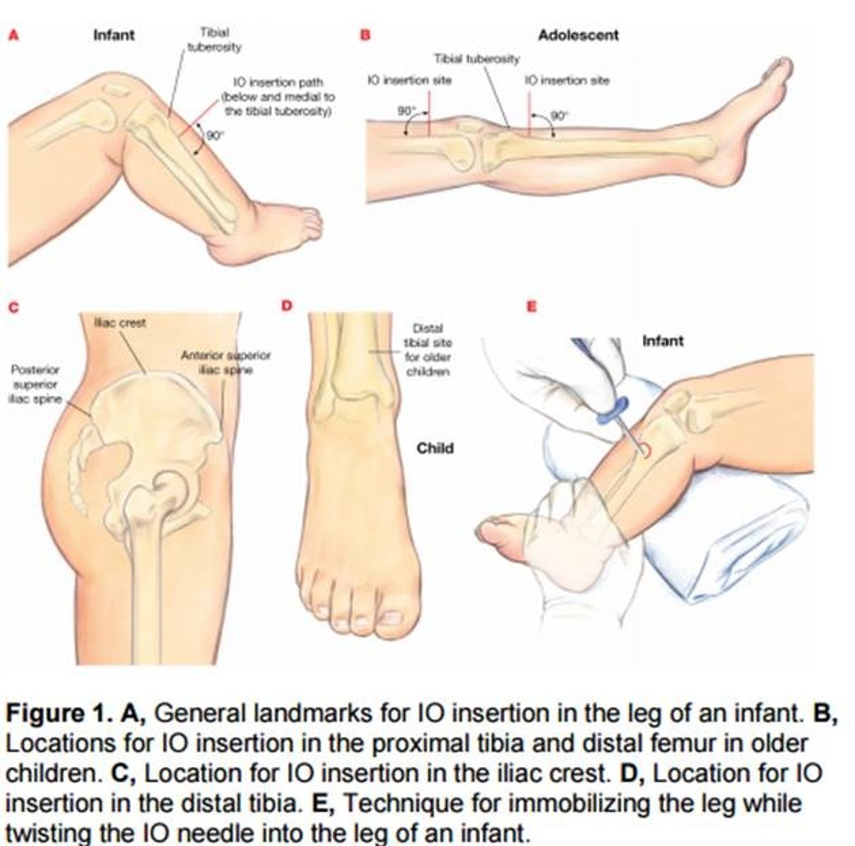 <p>accesses systemic circulation through bone barrow cavity</p>