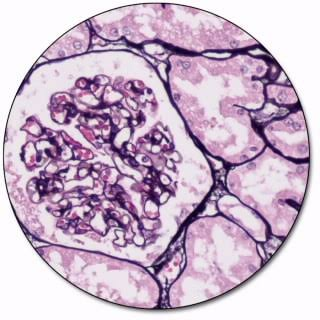 <p>Jones’ Basement Membrane (PAS-M) H&amp;E</p>