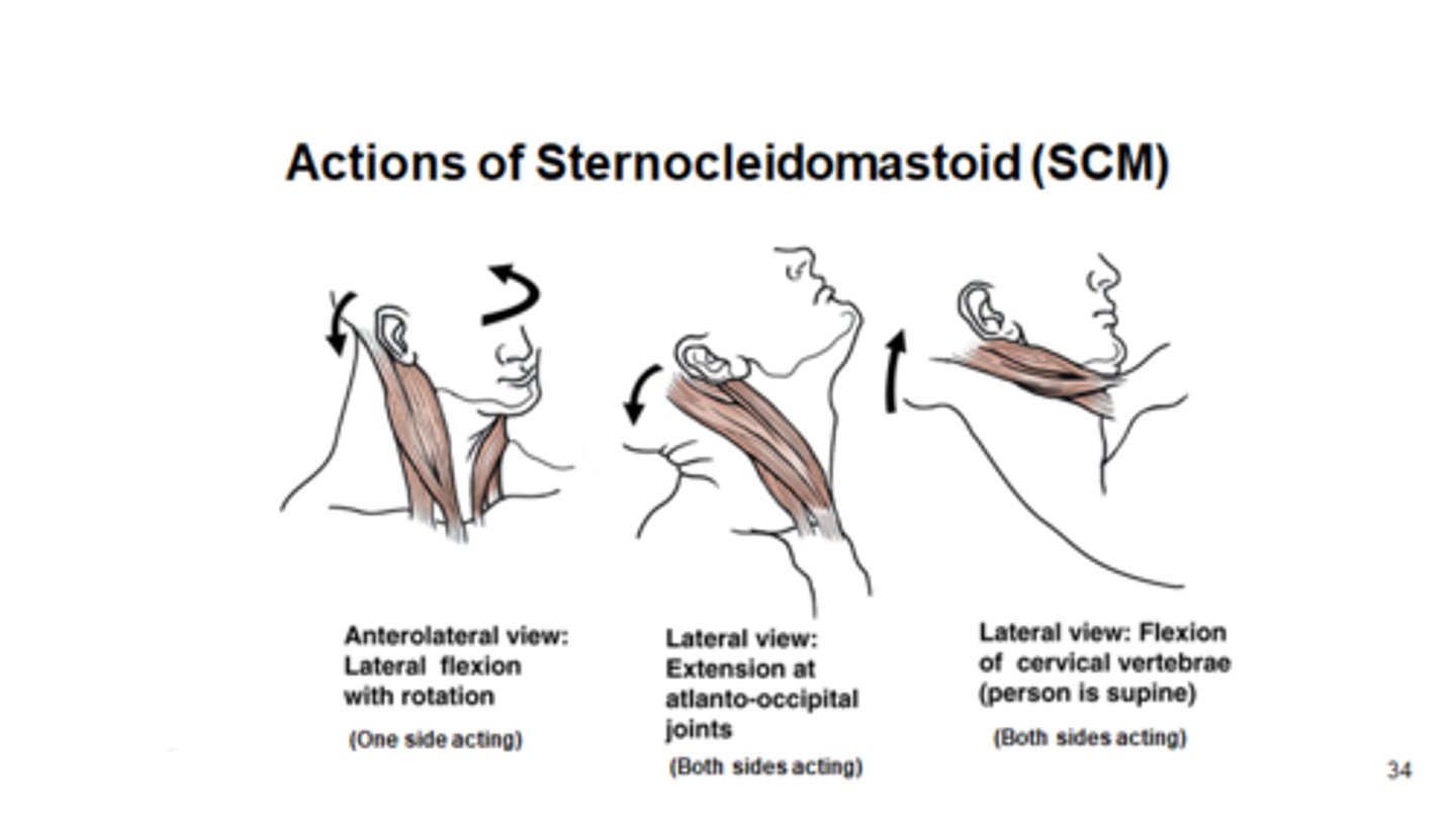 <p>sternocleidomastoid action</p>