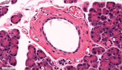 <p>What type of epithelial cell is shown?</p>