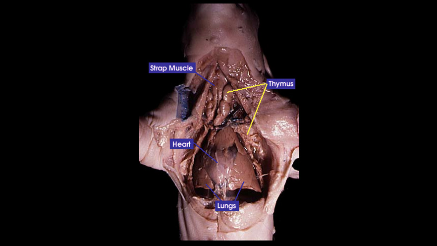 <p><span style="background-color: transparent;">The chest cavity that contains vital organs such as the heart and lungs.</span></p>
