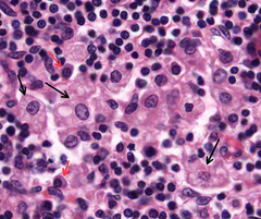 <p>What type of cells are indicated?</p>