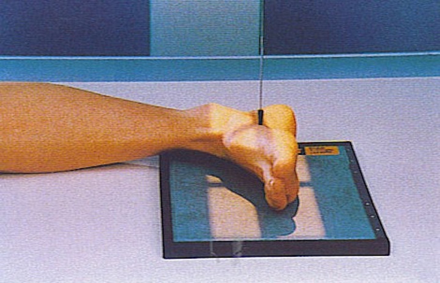 <p>S - on lap</p><p>T - 4.5 mAs @ 60 kVp</p><p>A - none</p><p>M - correct foot, on cassette</p><p>P - lateral side down, CR to 3rd metatarsal, directed @ medial cuneiform</p><p>S - 40"</p><p>B - hold</p><p>C - 10 x 12, C</p>