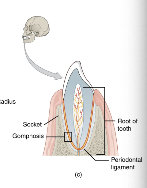 <p>type of fibrous joint in which the root of a tooth is anchored into its bony jaw socket by strong periodontal ligaments</p>