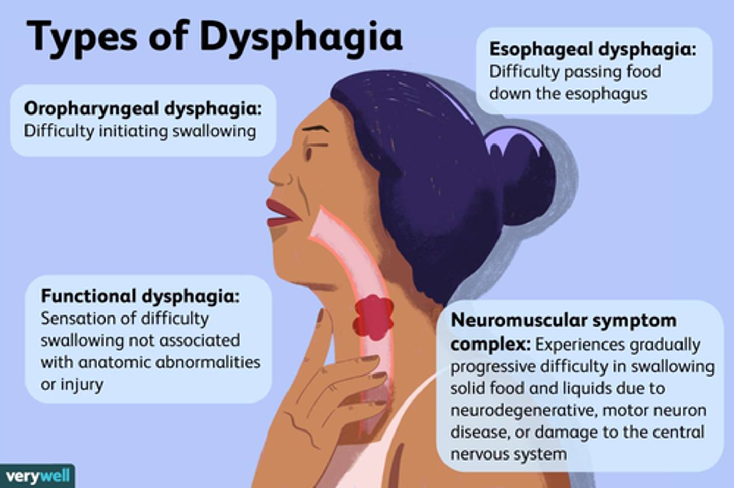 <p>A) If due to a food bolus, an EGD can be performed to remove it; If due to a neurological issue (e.g., stroke): chin to chest when swallowing, sit up 90 degrees when eating/drinking, no straws, thickened liquids as directed, chopped/ground food as directed, alternate bites &amp; sips</p>