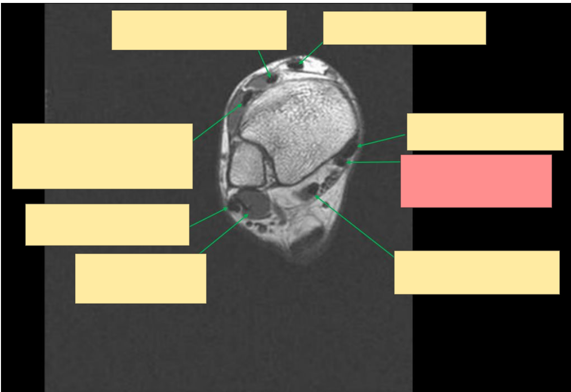 <p>Identify this structure</p>