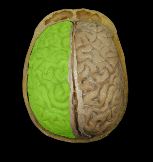 <p><span>Left cerebral hemisphere</span></p>