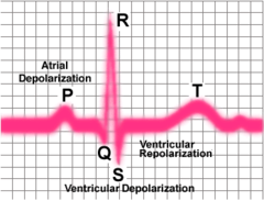 <p>electrocardiogram</p>