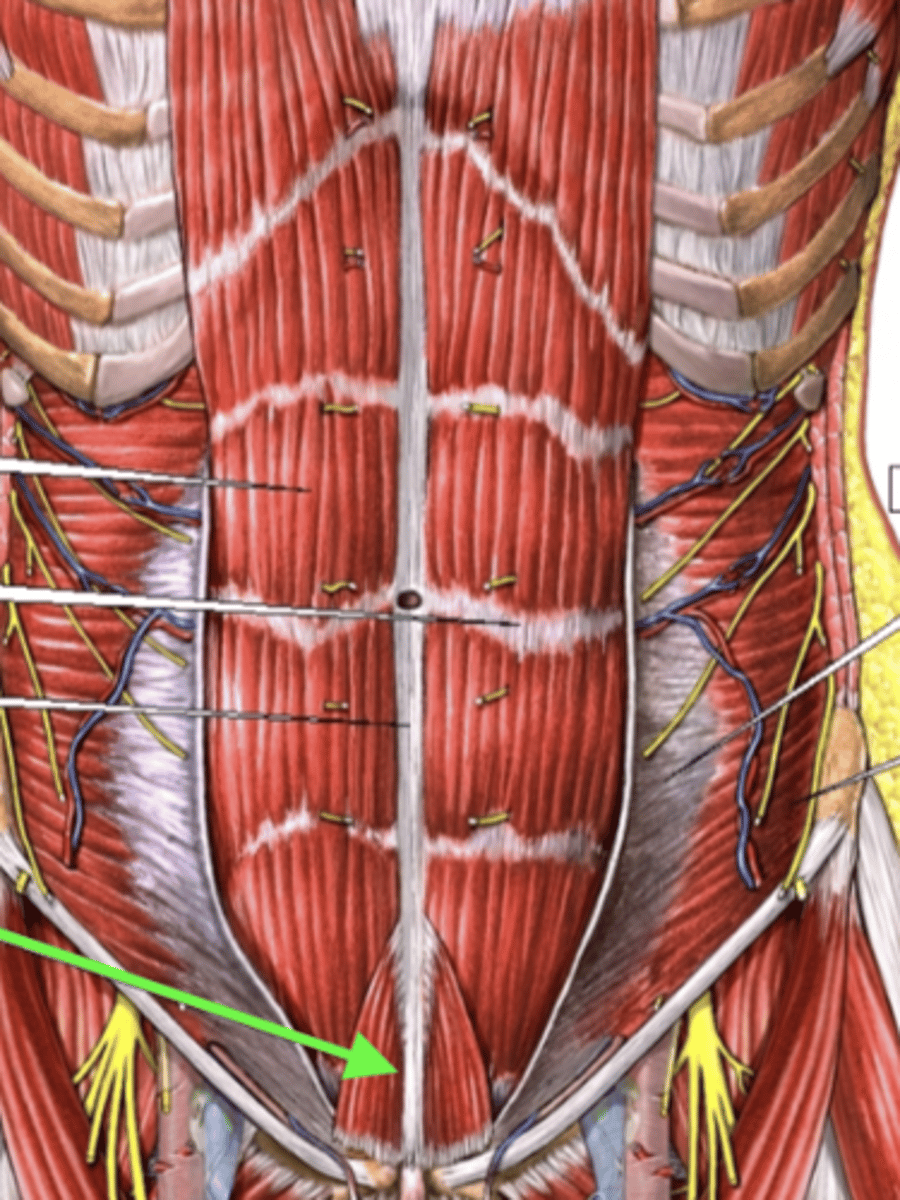 <p>what is this muscle?</p>