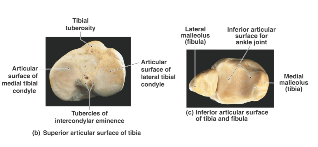 <p>What is the tibia <strong>comprised of</strong>?</p>