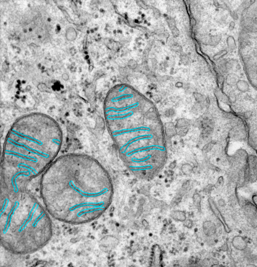 <p>Inner mitochondrial membrane</p>