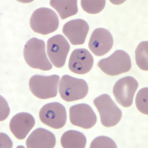 <p>Thin, delicate, 1/5 diameter of RBC</p><p>1-2 chromatin dots per ring</p><p>Multiple rings in one RBC</p><p>Normal RBC size</p>