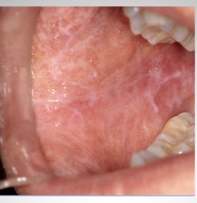 <p>What is this condition?</p>