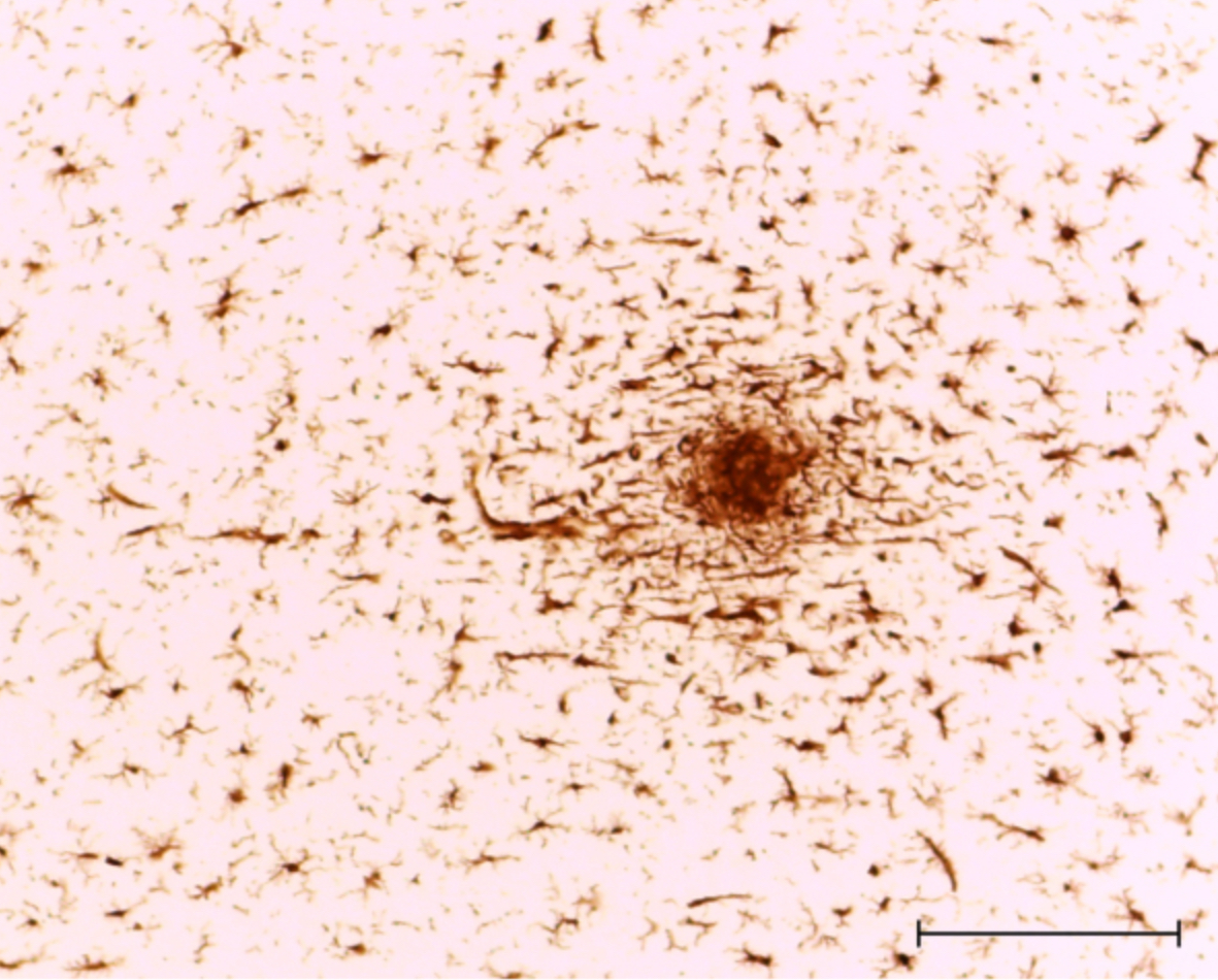 <p>What CNS cell type is this?</p><p>Buzzwords in a question stem that points towards this?</p>