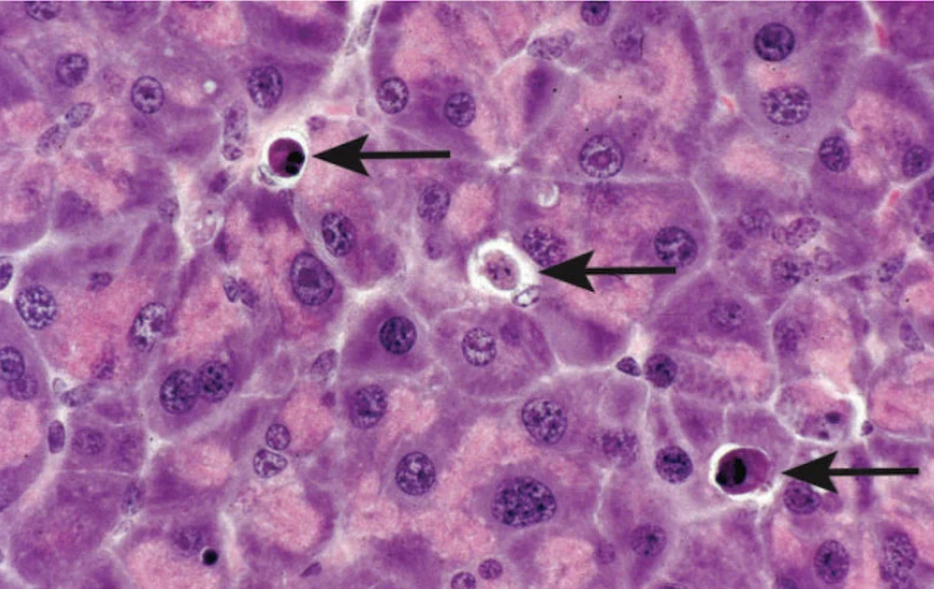 <p>What do the arrows represent</p>