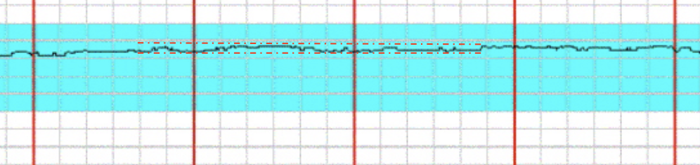 <p>this is what type of variability </p>